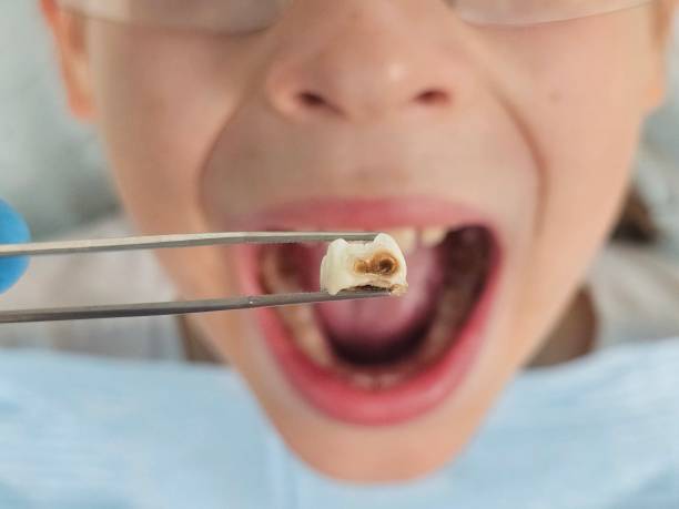 Best Emergency Denture Repair in Seville, FL